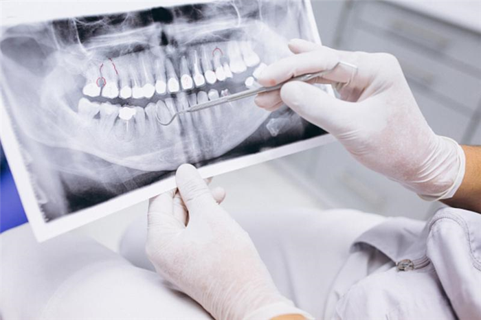 Как получить бесплатное удаление зубов по ОМС в Омске в 2024 году