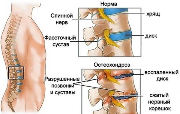 Необходимость больничного листа